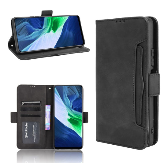 For Infinix Note 10 Skin Feel Calf Pattern Horizontal Flip Leather Case with Holder & Card Slots & Photo Frame(Black) - Infinix Cases by buy2fix | Online Shopping UK | buy2fix